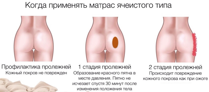 Пролежней матрас в минске прокат